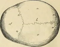 Picture 19 of 80 from Phrenologische Bilder : zur Naturlehre des menschlichen Geistes und deren Anwendung Wissenschaft und Leben (1855), leaf 341