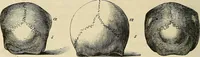 Picture 26 of 80 from Phrenologische Bilder : zur Naturlehre des menschlichen Geistes und deren Anwendung Wissenschaft und Leben (1855), leaf 347