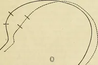 An illustration from Phrenologische Bilder : zur Naturlehre des menschlichen Geistes und deren Anwendung Wissenschaft und Leben (1855)