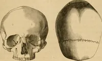 An illustration from Phrenologische Bilder : zur Naturlehre des menschlichen Geistes und deren Anwendung Wissenschaft und Leben (1855)