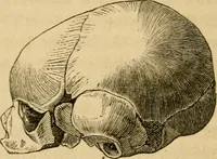 Picture 22 of 60 from Phrenologische Bilder : zur Naturlehre des menschlichen Geistes und deren Anwendung Wissenschaft und Leben (1855), leaf 335
