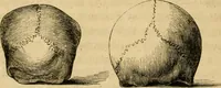 An illustration from Phrenologische Bilder : zur Naturlehre des menschlichen Geistes und deren Anwendung Wissenschaft und Leben (1855)
