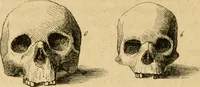 An illustration from Phrenologische Bilder : zur Naturlehre des menschlichen Geistes und deren Anwendung Wissenschaft und Leben (1855)
