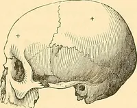 An illustration from Phrenology applied to painting and sculpture (1855)