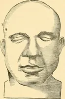 An illustration from Phrenology, and how to use it in analyzing character (1871)