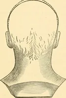 Picture 56 of 74 from Phrenology, and how to use it in analyzing character (1871), leaf 314