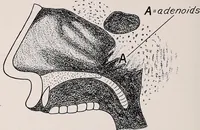 An illustration from Physical education complete for schools and playgrounds (1915)