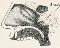 An illustration from Physical education complete for schools and playgrounds (1915)