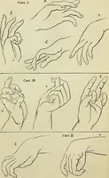 Picture 15 of 48 from Physical expression : its modes and principles (1885), leaf 157