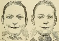 An illustration from Physical expression : its modes and principles (1885)