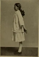 An illustration from Physical training for the elementary schools, gymnastics, games, and rhythmic plays (1917)