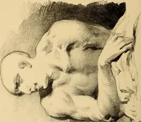 An illustration from The physiognomy of mental diseases (1838)