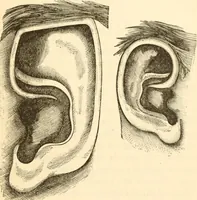 Picture 53 of 258 from Physiognomy illustrated ; or, Nature's revelations of character : a description of the mental, moral, and volitive dispositions of mankind, as manifested in the human form and countenance (1891), leaf 180