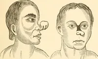 An illustration from Physiognomy illustrated ; or, Nature's revelations of character : a description of the mental, moral, and volitive dispositions of mankind, as manifested in the human form and countenance (1891)