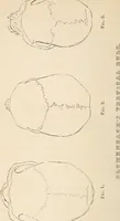 Picture 3 of 10 from Physiognomy founded on physiology, and applied to various countries, professions, and individuals; (1834), leaf 93