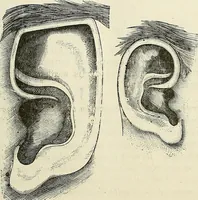 Picture 51 of 255 from Physiognomy illustrated; or, nature's revelations of character. A description of the mental, moral, and volitive dispositions of mankind, as manifested in the human form and countenance (1887), leaf 182