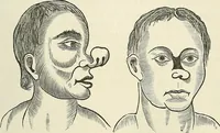 Picture 228 of 255 from Physiognomy illustrated; or, nature's revelations of character. A description of the mental, moral, and volitive dispositions of mankind, as manifested in the human form and countenance (1887), leaf 542