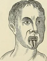 Picture 235 of 255 from Physiognomy illustrated; or, nature's revelations of character. A description of the mental, moral, and volitive dispositions of mankind, as manifested in the human form and countenance (1887), leaf 546
