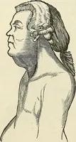 Picture 11 of 255 from Physiognomy illustrated; or, nature's revelations of character. A description of the mental, moral, and volitive dispositions of mankind, as manifested in the human form and countenance (1887), leaf 85