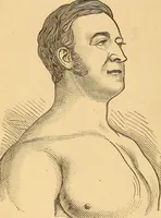 Picture 7 of 49 from Physiognomy. A practical and scientific treatise (1881), leaf 49