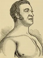 An illustration from Physiognomy : A practical and scientific treatise. Being a manual of instruction in the knowledge of the human physiognomy and organism, considered chemically, architecturally, and mathematically; embracing the discoveries of located traits, with their relative organs and signs of character, together with the three grand natural divisions of the human face (1881)