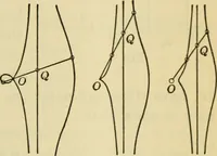 An illustration from Plane and solid analytic geometry (1921)
