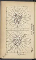 An illustration from Practical guide for charting and interpreting the visual color fields (1928)