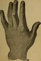 An illustration from Practical cheirosophy, a synoptical study of the science of the hand (1887)