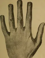 An illustration from Practical cheirosophy, a synoptical study of the science of the hand (1887)