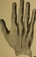 An illustration from Practical cheirosophy, a synoptical study of the science of the hand (1887)
