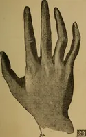 An illustration from Practical cheirosophy, a synoptical study of the science of the hand (1887)