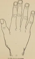 An illustration from Practical palmistry : a reliable treatise on the art of character reading and methods of recalling past and foretelling future events upon examination of the hand (1904)