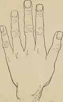 An illustration from Practical palmistry : a reliable treatise on the art of character reading and methods of recalling past and foretelling future events upon examination of the hand (1904)