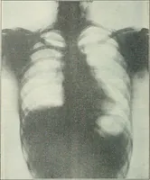 An illustration from Practical physics (1922)