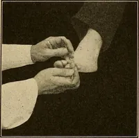 An illustration from Practical podiatry : (1918)