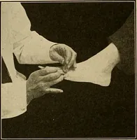 An illustration from Practical podiatry : (1918)