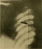 An illustration from Practical radiography : a handbook for physicians, surgeons, and other users of X-rays (1901)