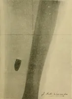 An illustration from Practical radiography : a handbook for physicians, surgeons, and other users of X-rays (1901)
