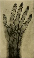 An illustration from Practical radiography : a handbook for physicians, surgeons, and other users of X-rays (1901)