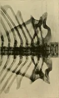 An illustration from Practical radiography : a handbook for physicians, surgeons, and other users of X-rays (1901)