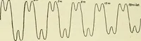 An illustration from The practical telephone handbook and guide to the telephonic exchange (1906)