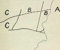 An illustration from Practical town planning (1914)