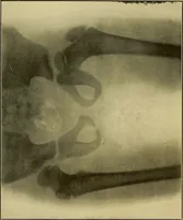 Picture 1 of 43 from Practical X ray work (1901), leaf 11