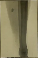 An illustration from Practical X ray work (1901)