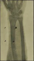 An illustration from Practical X ray work (1901)