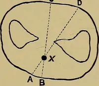 An illustration from Practical X ray work (1901)