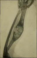 An illustration from Practical X ray work (1901)