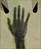 An illustration from Practical X ray work (1901)