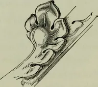 An illustration from The principles of Gothic ecclesiastical architecture : with an explanation of technical terms and a centenary of ancient terms ... (1882)