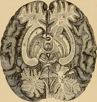 An illustration from The principles of light and color : including among other things the harmonic laws of the universe, the etherio-atomic philosophy of force, chromo chemistry, chromo therapeutics, and the general philosophy of the fine forces, together with numerous discoveries and practical applications. Illustrated by more than two hundred engravings and four colored plates (1896)